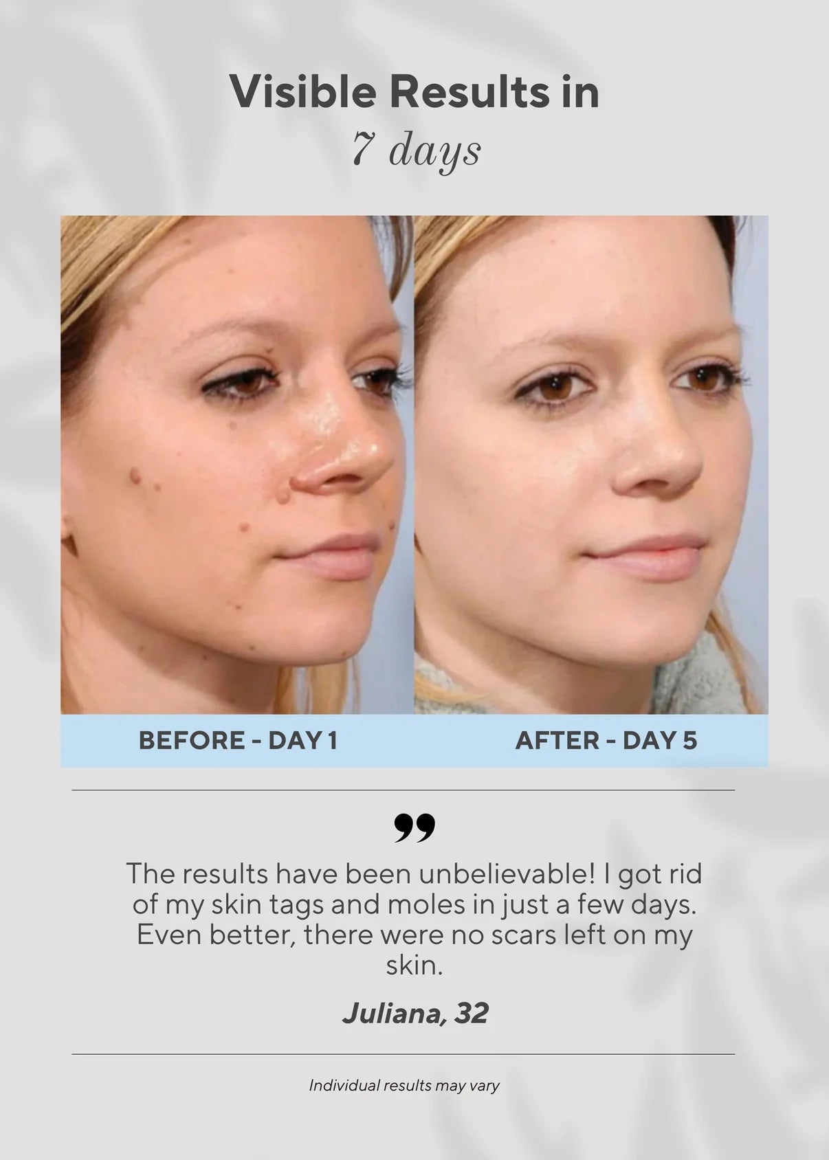 Neurova Mole And Spot Removal Pen